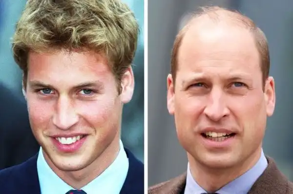 Знаменитости, которых с возрастом стало не узнать