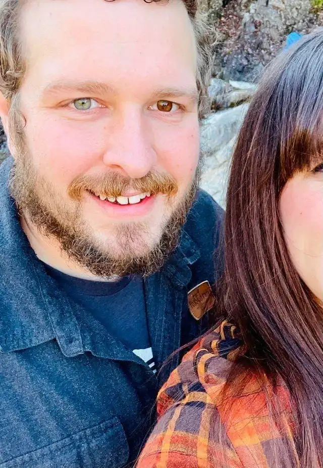 Не такие, как все: 15 фотографий людей с нестандартной внешностью