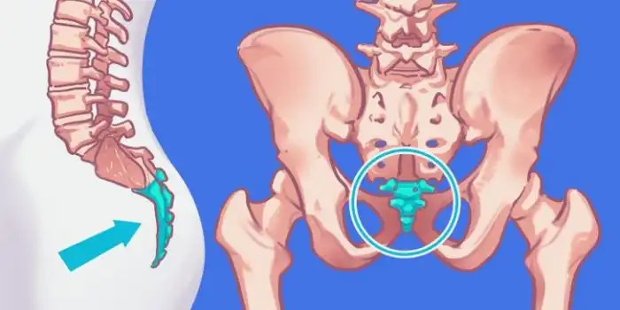 Почему у человекообразных обезьян нет хвостов?