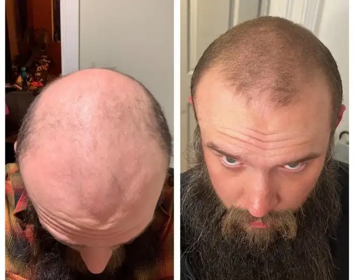 14 фото, которые показывают прогресс во всей красе