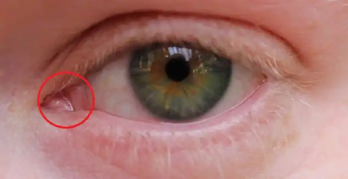 Почему глаза птиц иногда становятся жуткого бледного цвета?