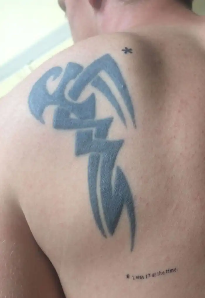 Тату, о которых владельцам больно вспоминать