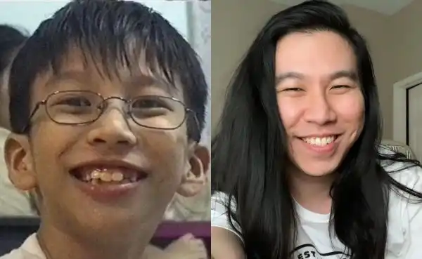 "Гадкие утята", которые выросли и изменились до неузнаваемости