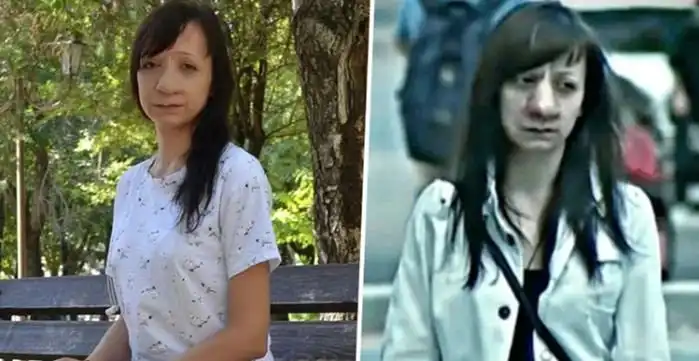 Яне Муратовой из передачи "Прямой эфир" сделали операцию на носу. Как девушка выглядит спустя 4 года