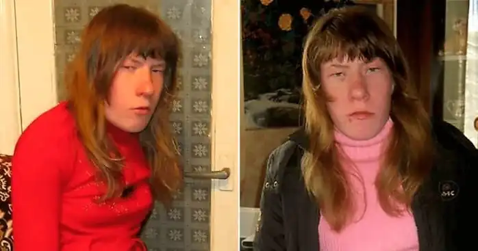 Девушка "мем", над которой "смеялся весь интернет" вышла замуж и нашла работу. Её внешность и жизнь спустя 7 лет