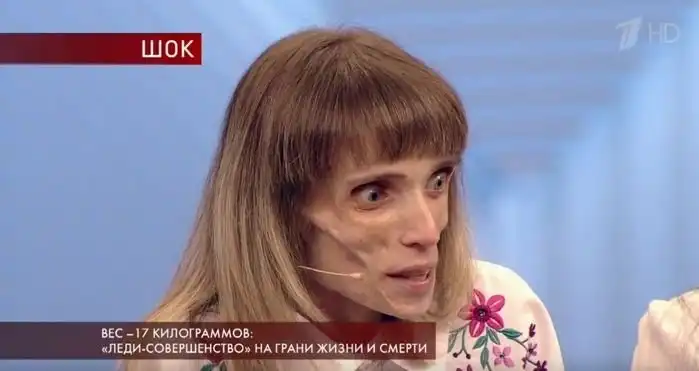 Она боялась поправиться: как сейчас выглядит Кристина Корягина, которая весила 17 кг