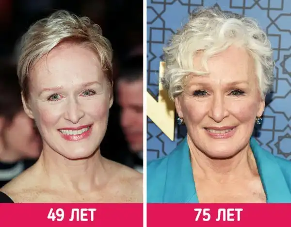 Как изменились знаменитости с возрастом