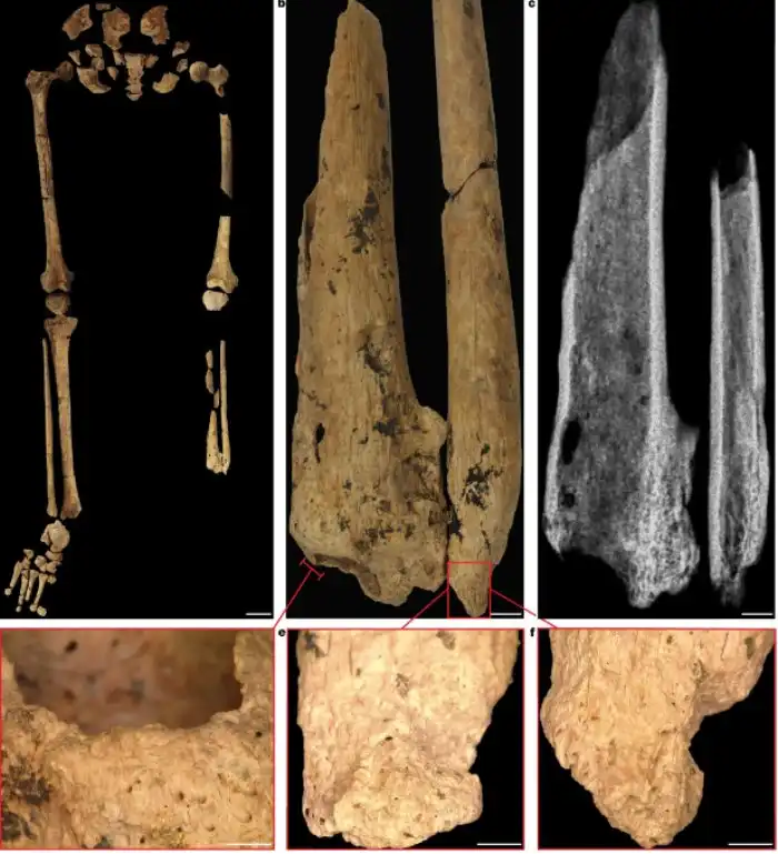 Древнее здравоохранение: зачем неандертальцы и другие гоминиды заботились о безнадёжно больных товарищах?