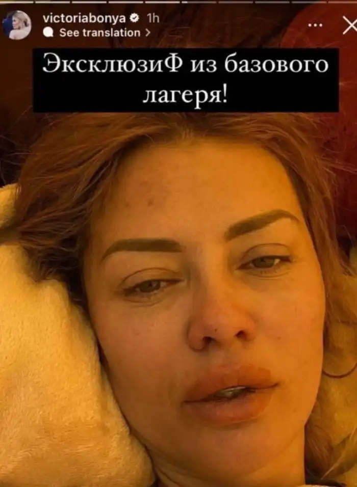 Ну что ж ты страшная такая: отечественные звёзды без макияжа