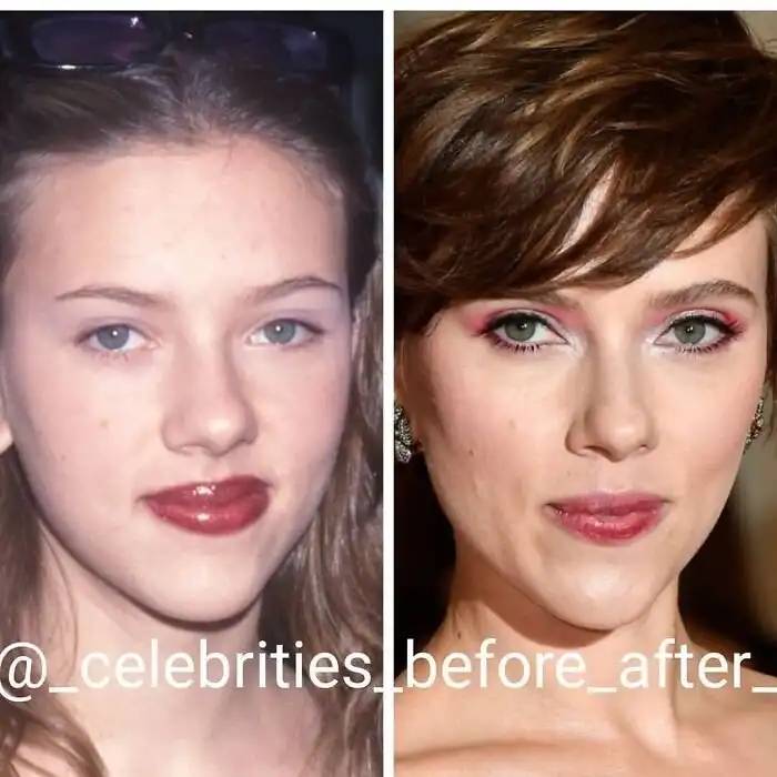 Тогда и сейчас: как знаменитости изменились с годами