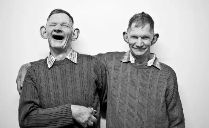 История необычных братьев близнецов: что с ними стало и как они прожили свою жизнь