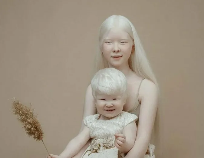 Жизнь белокурых принцесс: каким образом в семье казахов появились девочки альбиносы?