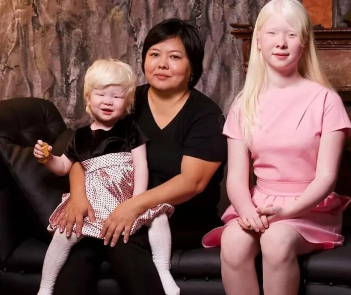 Жизнь белокурых принцесс: каким образом в семье казахов появились девочки альбиносы?