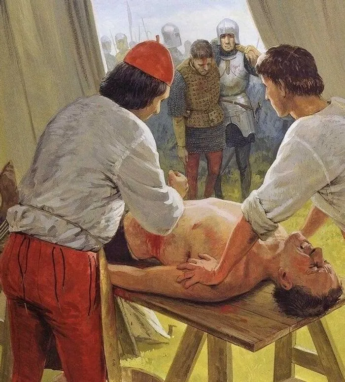 Шансы выжить у раненого воина в Средневековье