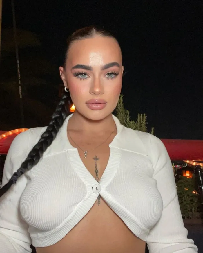 Девушка увеличила губы и пожалела об этом - своим неудачным опытом она поделилась в соцсетях