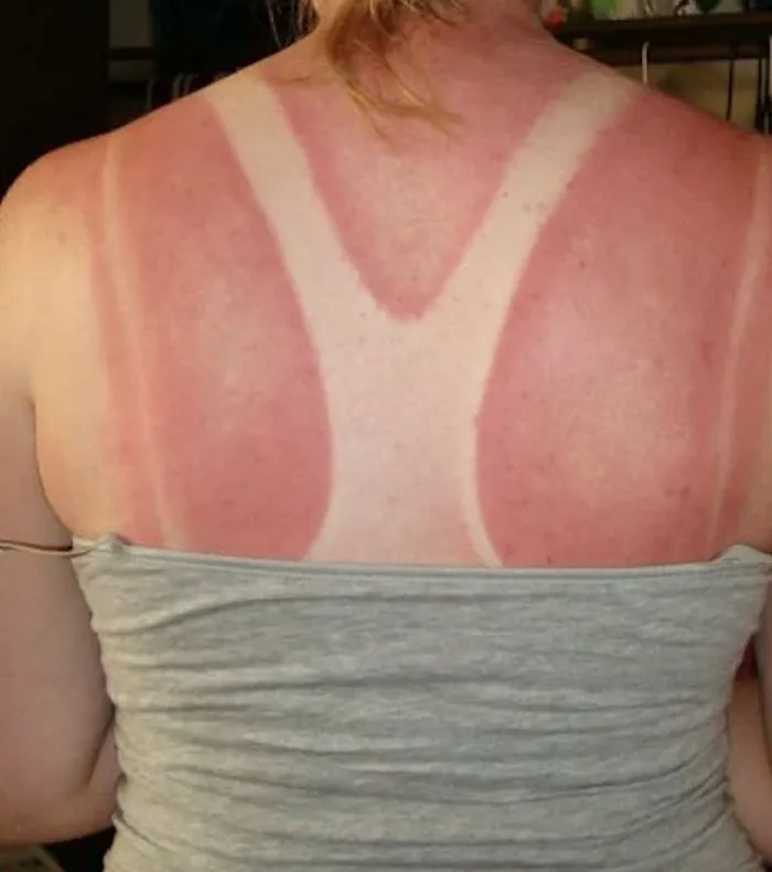 Бедолаги, которых "наказало" солнце