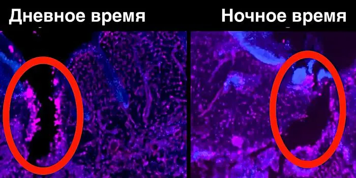 Почему раны, полученные днем, заживают быстрее ночных? Объясняю с научной точки зрения