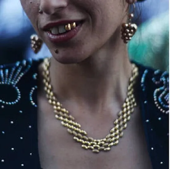 Зачем цыгане вставляют золотые зубы