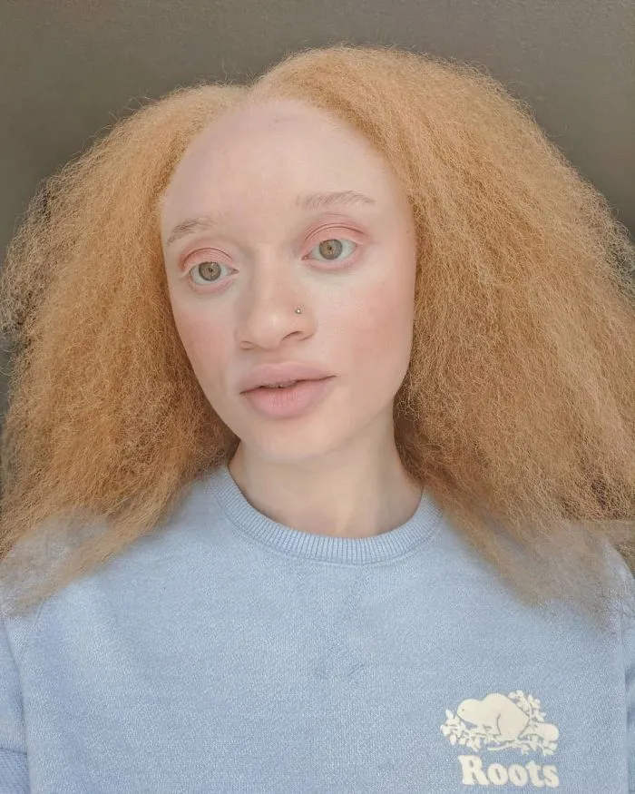 Необычные гены: западноафриканская модель с альбинизмом