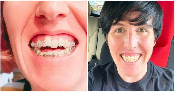 Перемены к лучшему: Люди, которые сходили к стоматологу