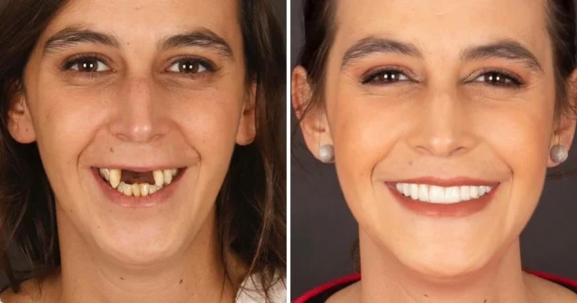 Исцеляющая улыбка: португальский дантист и его потрясающие трансформации пациентов