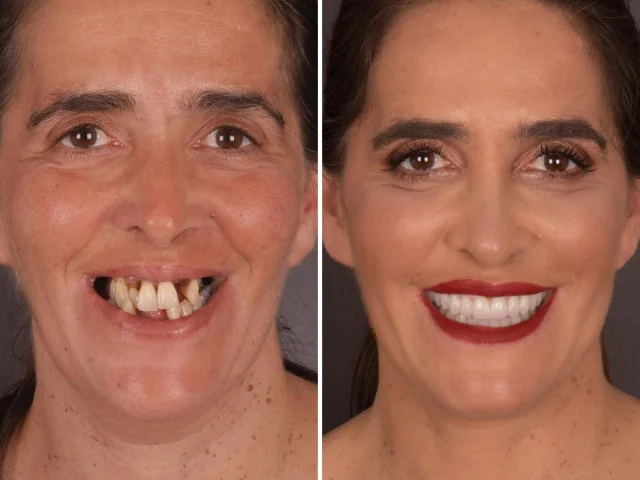 Исцеляющая улыбка: португальский дантист и его потрясающие трансформации пациентов