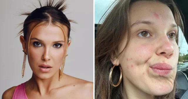 Естественная красота: Знаменитости до и после макияжа
