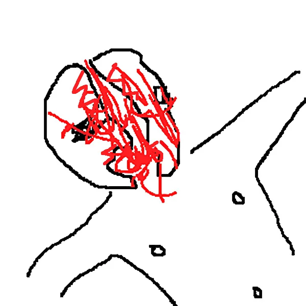 Человек-ракушка что с ним сейчас? Полная история Неудачного прыжка в воду