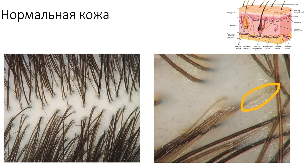 Рекомендации трихолога: правильное мытье головы