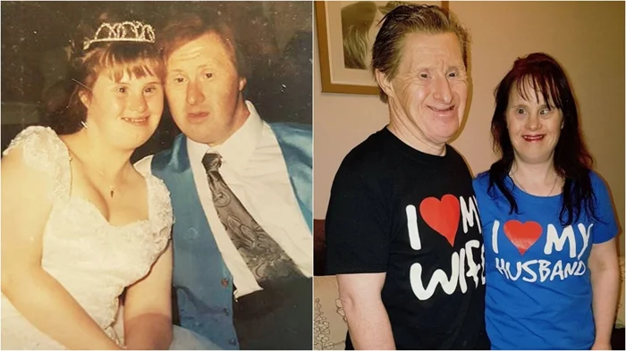 Как сложилась судьба первой пары с синдромом Дауна, которая поженилась 29 лет назад