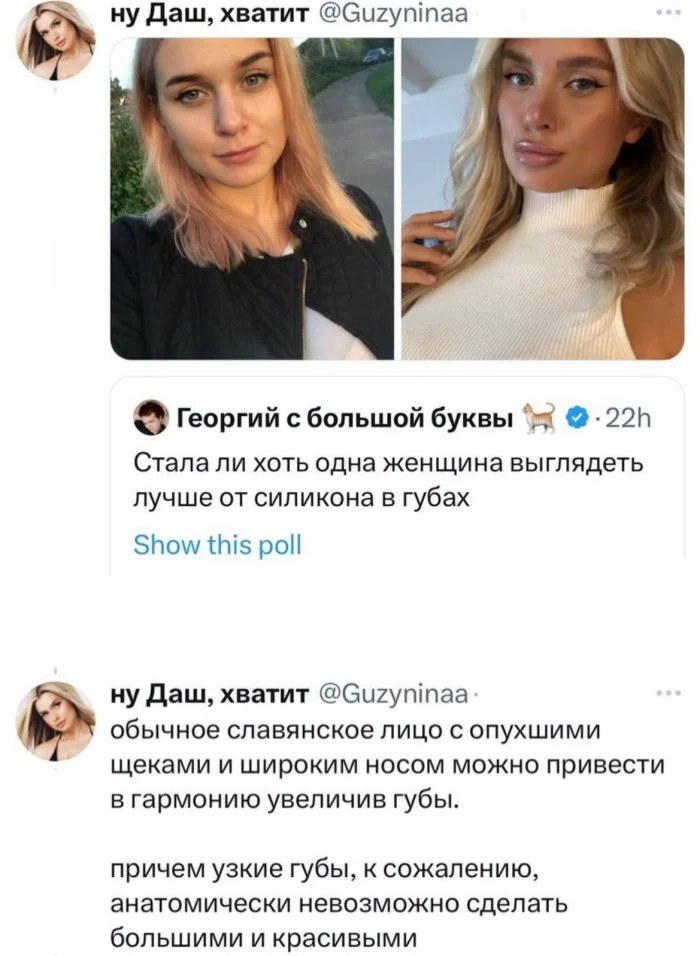 Увеличенные губы: стиль или перебор? Обсуждение в соцсетях