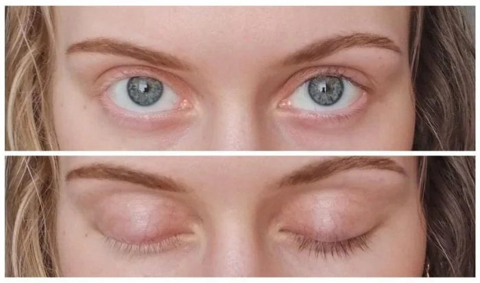 Матушка-природа постаралась: 16 людей с особенными чертами