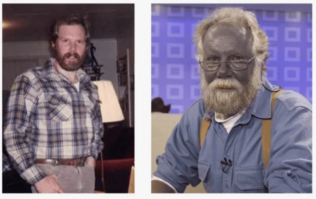 Как попытка укрепить здоровье сделала Пола Карасона «синим человеком»