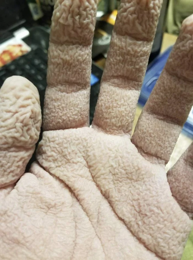 40 удивительных способностей человеческого тела и достижений медицины