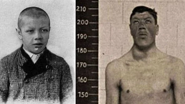 Адам Райнер: трагедия карлика, ставшего гигантом