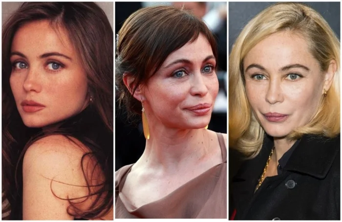 Когда стремление к молодости обернулось бедой: звезды, испортившие свою внешность