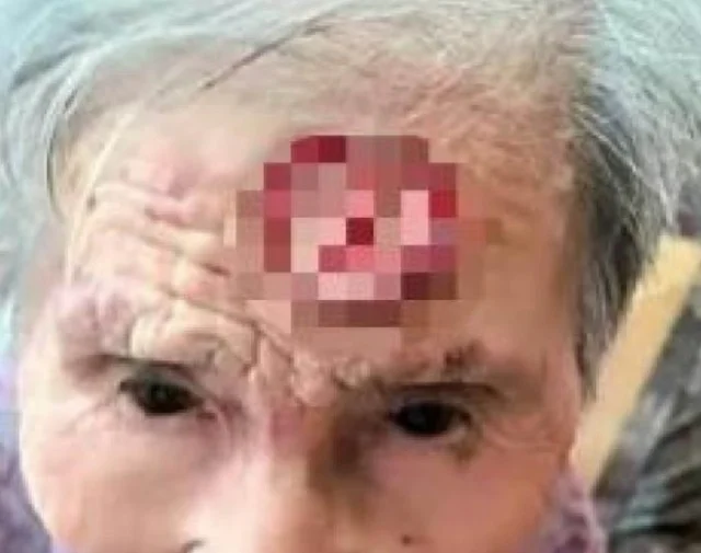 Китаянка решила отрезать «рог долголетия» — вот что произошло