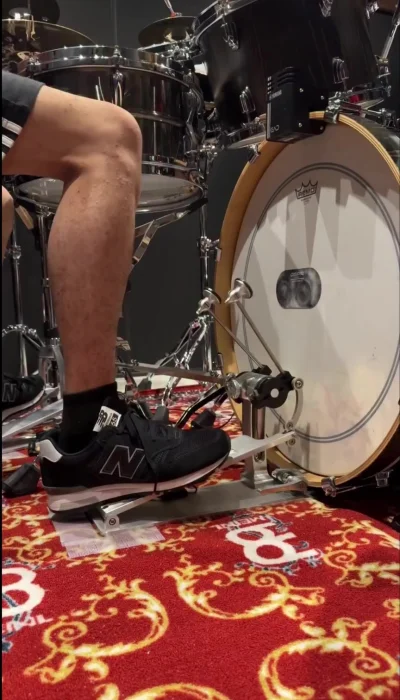 Синдром беспокойных ног