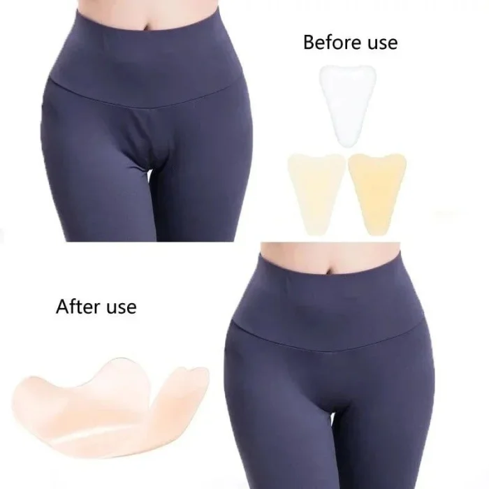 Новый тренд или полный абсурд: силиконовые накладки против «верблюжьей лапки»