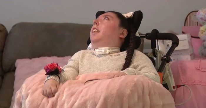 Девушке, родившейся без мозга исполнилось 20 лет