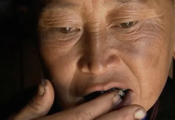 Черные зубы или изгойство: выбор за вами