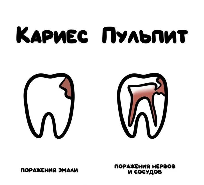Слова, которые часто путают: в чём разница #56