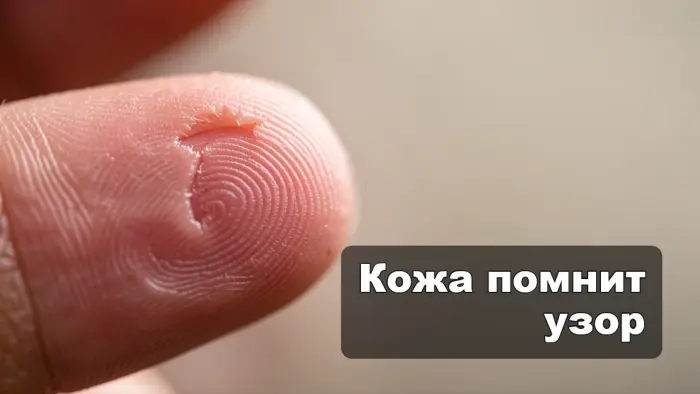 Почему отпечатки пальцев восстанавливаются после неглубоких порезов